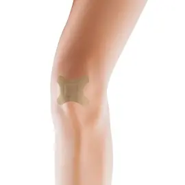 Knie- en elleboogpleister 'Allround', huidskleur - Lifemed 
